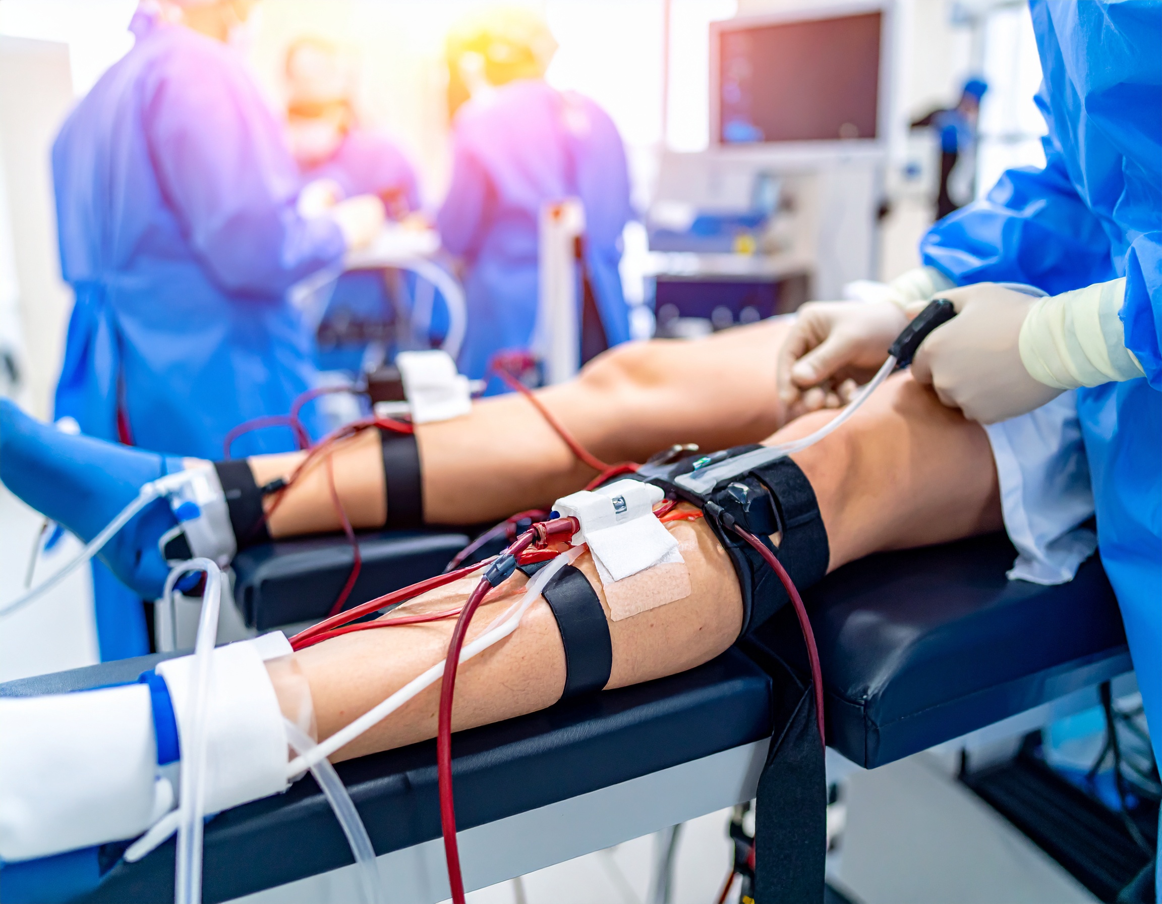 Dialysis Access Overview